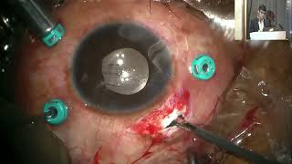 Aiocmtc4 2025 -Videos General Segment