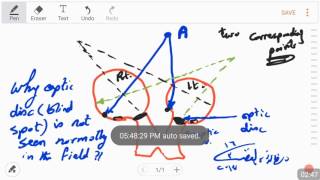 Why the physiological blind spot is not seen normally? (4-2017) by Dr Khaled A Abulfadle