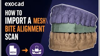 How to import a new bite alignment scan in EXOCAD 