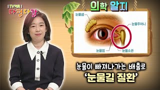 ‘의학 알지’ 눈물길 질환 / KBS대전 202100513 방송