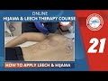 21 free online hijama  leech therapy course how to apply leech  hijama