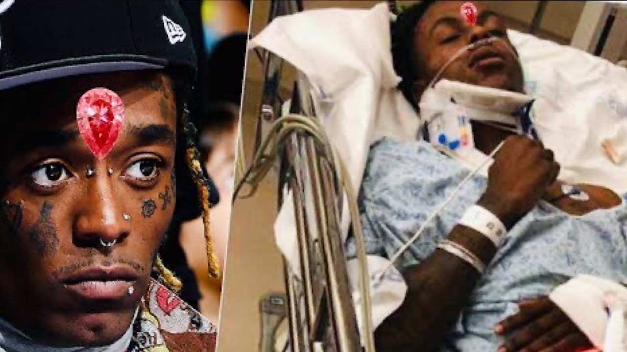 Lil Uzi Vert HOSPITALIZED by $24M pink diamond face implant "GET IT OUT