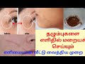 தழும்புகள் எளிதில் மறைய இதைச் செய்யுங்கள் / How To Remove Any Scars in tamil