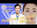 Можно ли сделать &quot;лисьи глазки&quot;? | Пластические операции на глаза. Dr. Paik Hye-Won