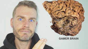 Why I