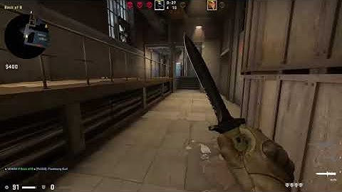 Epic 1v5 Clutch in CS| Insane Gameplay Short