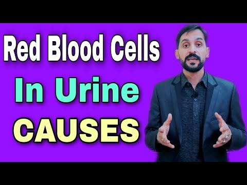 Red Blood Cells in Urine || Causes