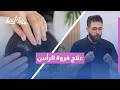 حرب الصيف ضد القشرة! 🧴⚠️ فروة الرأس الدهنية: الأسباب الحقيقية وخطة العلاج الطبيّة لعام 2026