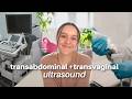 Transvaginal &amp; Transabdominal Ultrasound Experience (what to expect)