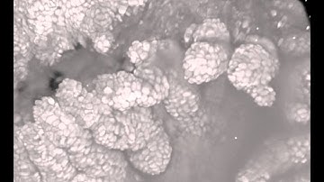 Appendage Morphogenesis in Crustacean Model Parhyale Hawaiensis