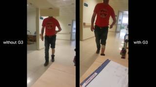 Patient try G3 foot drop system