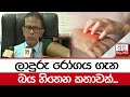 ලාදුරු රෝගය ගැන බය හිතෙන කතාවක්...