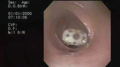 Colonoscopies without the doctor?