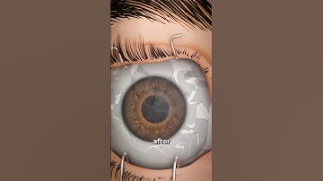 What Happens If You Don