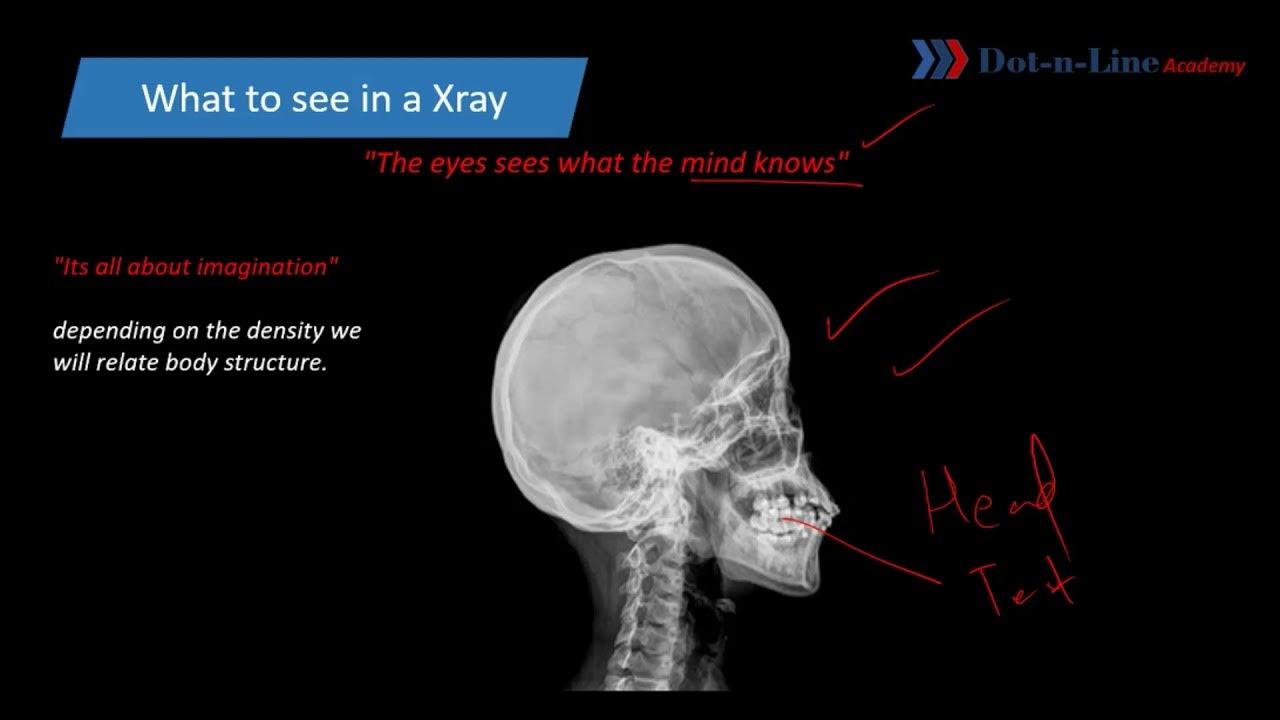All about XRAYS What is XRay How X Rays are formed How to see a