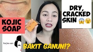 KOJIE SAN SOAP REVIEW! NAKAKAITIM AT DRY NG BALAT!!! / PAANO GAMITIN NG TAMA? jammyllagas