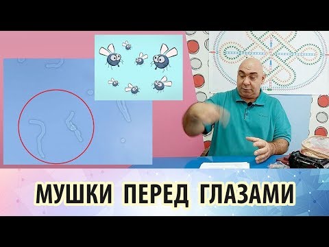 Мушки в глазах. Почему они появляются и как от них избавиться