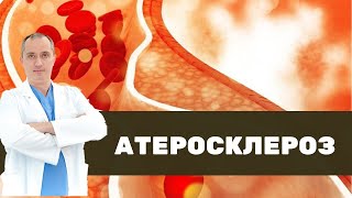 ❤ Что такое атеросклероз на самом деле?