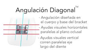 Brackets Serie Master American Orthodontics