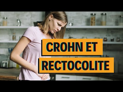 Vidéo: Greffe De Cellules Souches Autologues Dans La Maladie De Crohn Réfractaire - évaluation De Thérapie De Faible Intensité (ASTIClite): Protocoles D'étude Pour Un Essai Contrôlé