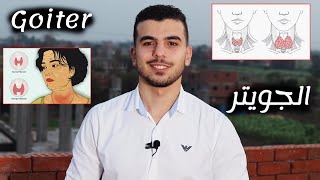 #أحياء_تالته_ثانوى | الجويتر البسيط والجحوظى   Goiter disease