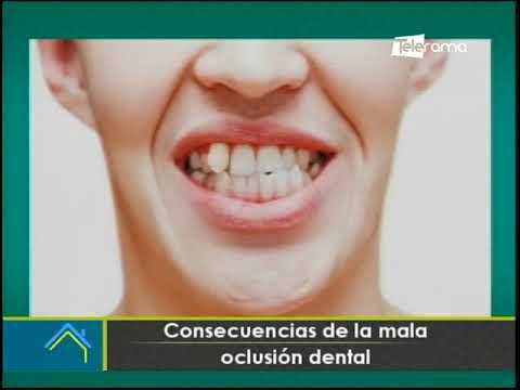 Consecuencias de la mala oclusión dental YouTube