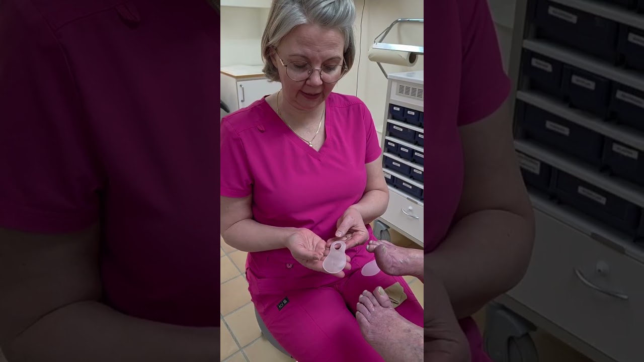 Hallux Valgus fakta och potentiell lösning 