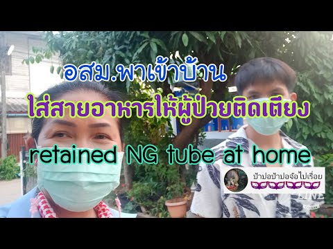 ใส่สายฟีดอาหารให้ผู้ป่วยติดเตียงที่บ้าน retained NG tube at home