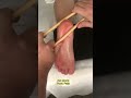 Foot Massage with Bamboo Sticks – Deep Relaxation & Tension Release 🌿💆♂️