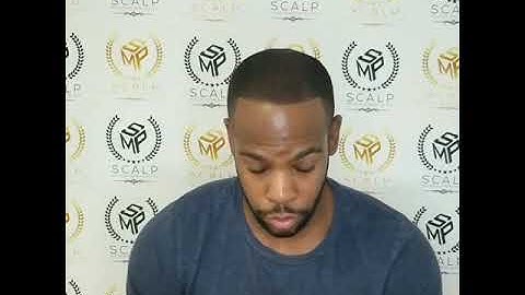 Scalp Micropigmentation Testimonals