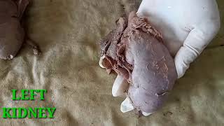 ANATOMY OF KIDNEY - BY DR MITESH DAVE screenshot 4