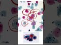CERVIX HISTOLOGY -19 #neetpg #pathology #histopathology #mdpathology