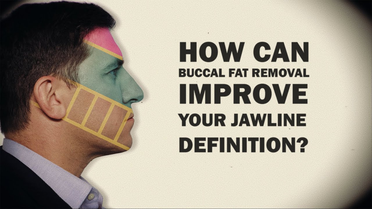 Buccal Fat Removal Does NOT Define Your Jawline! Here’s Why | Dr. Jonathan Zelken