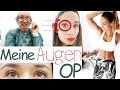 Augen Lasern Erfahrung - Meine OP - Vlog - Kosten, Schmerzen - Nie mehr Brille - *REUPLOAD*