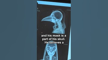 SKULL OPENED! Why does SCP-049 do this?