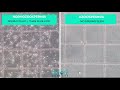 Azoospermia | Lack of Sperms in Semen Sample | Comparison with Normal Semen Sample