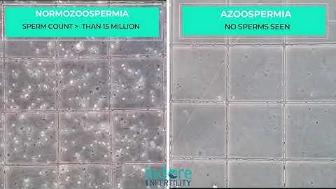 Azoospermia | Lack of Sperms in Semen Sample | Comparison with Normal Semen Sample