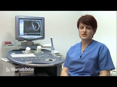 Video: Ultrazvučna Dijagnostika Tokom Trudnoće: Moguće Posljedice Za Fetus