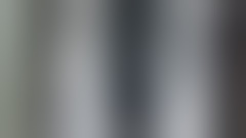 Ilizarov in infected tibia fracture non union - Dr Hoda Ilizarov cases