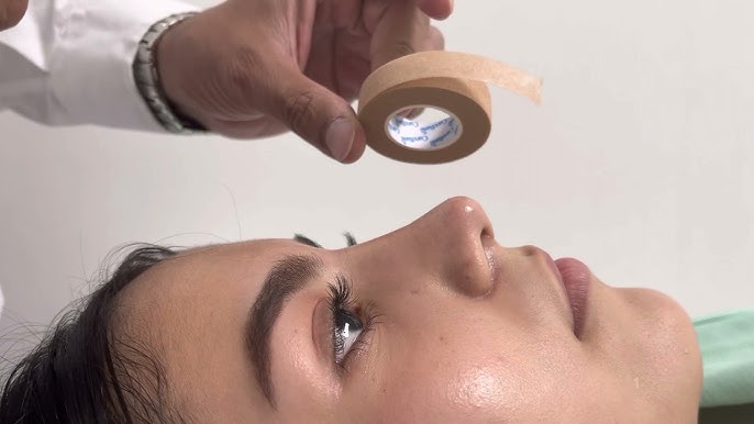 Cómo se colocan las cintas de micropore en la nariz, después de una  rinoplastia? 