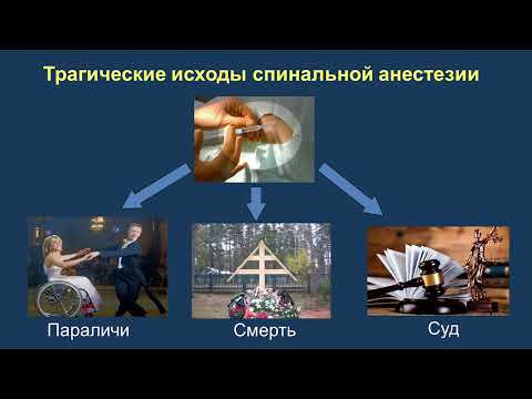 Спинальная анестезия