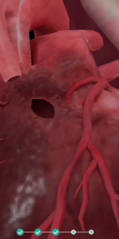 심장 수술 | heart operation | 心臓手術 | operasi jantung | операция на сердце ...