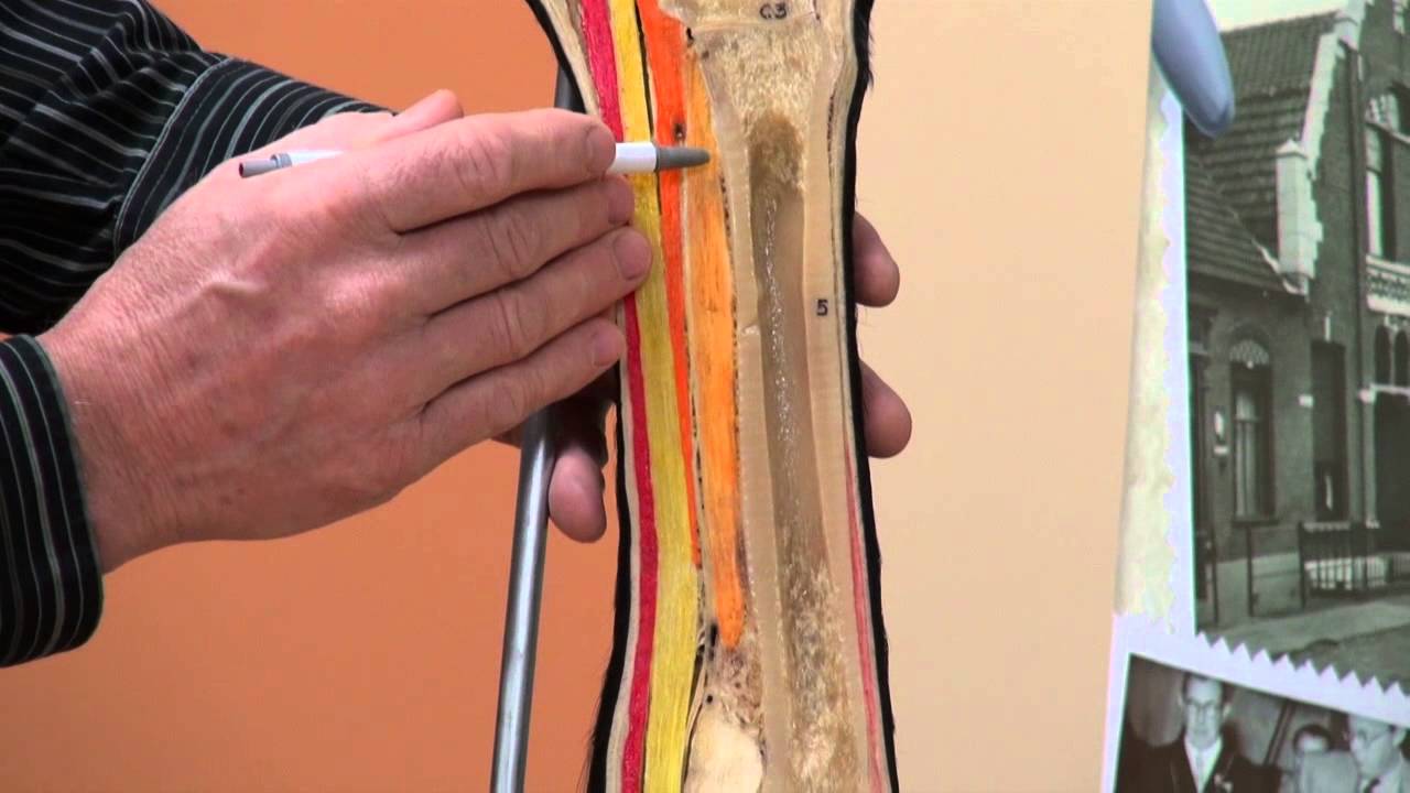 Anatomy of the Hoof & Lower Limb   Part 2