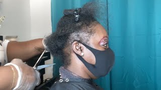 How to fix damaged hair| Wearing wigs for a long time damaged her hair line