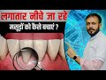 नीचे जा रहे मसूड़ो का घरेलू इलाज | Best Home Remedies for Gum Recession Hindi