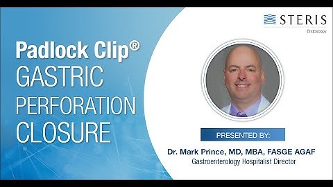 Padlock Clip® Gastric Perforation Closure – Dr. Mark Prince