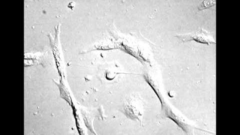 Bioptechs FCS2, Human Breast Cancer Cells Metastasizing