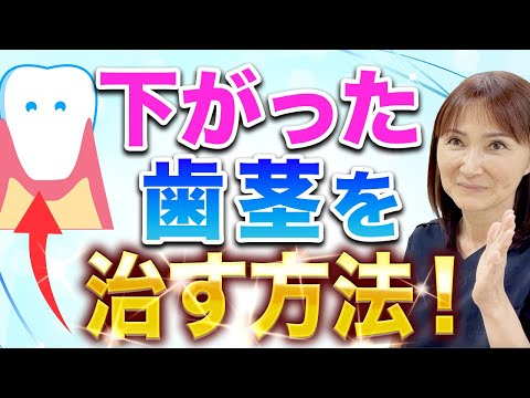 【今すぐ対策】下がった歯茎を自分で治す方法！自宅で３分！ある方法で劇的に変わります！