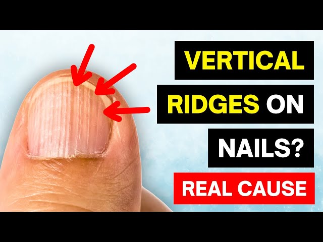 15 common nail conditions & how to deal with them – Scratch