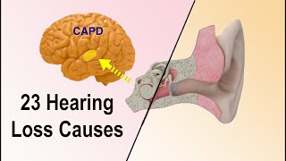 Hearing Loss Causes  23 Different Reasons Why Hearing Loss Occurs!